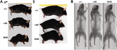 Increased osteoclastogenesis contributes to bone loss in the Costello syndrome Hras G12V mouse model